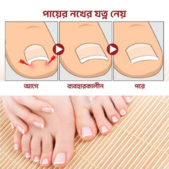 নখ রিপেয়ার অয়েল - টো-নেইল প্লাস