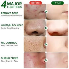 Korean Green Tomato Clay Mask Cleanser – 120ml