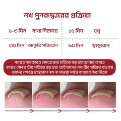 নখ রিপেয়ার অয়েল - টো-নেইল প্লাস